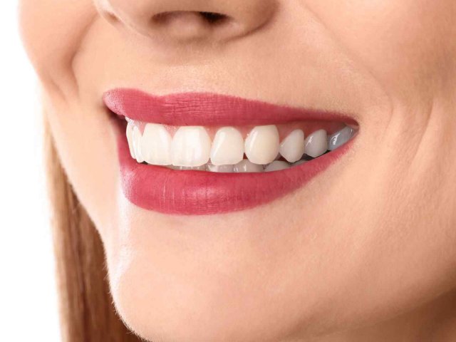 https://sedauz.com/wp-content/uploads/2020/03/service_whitening-640x480.jpg